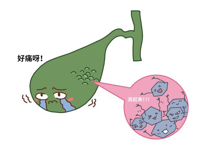 胆结石拖一拖无所谓？四川胆结石专家提醒及时就医！(图4)