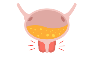 身体在报警！排尿异常背后的“真凶”，可能是膀胱结石【四川结石病专科医院】(图3)