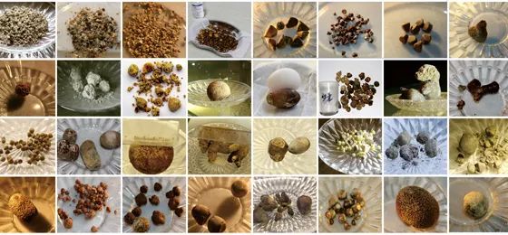 患了胆囊结石，吃药可以化掉吗？来听听肝胆科主任怎么说！(图9)