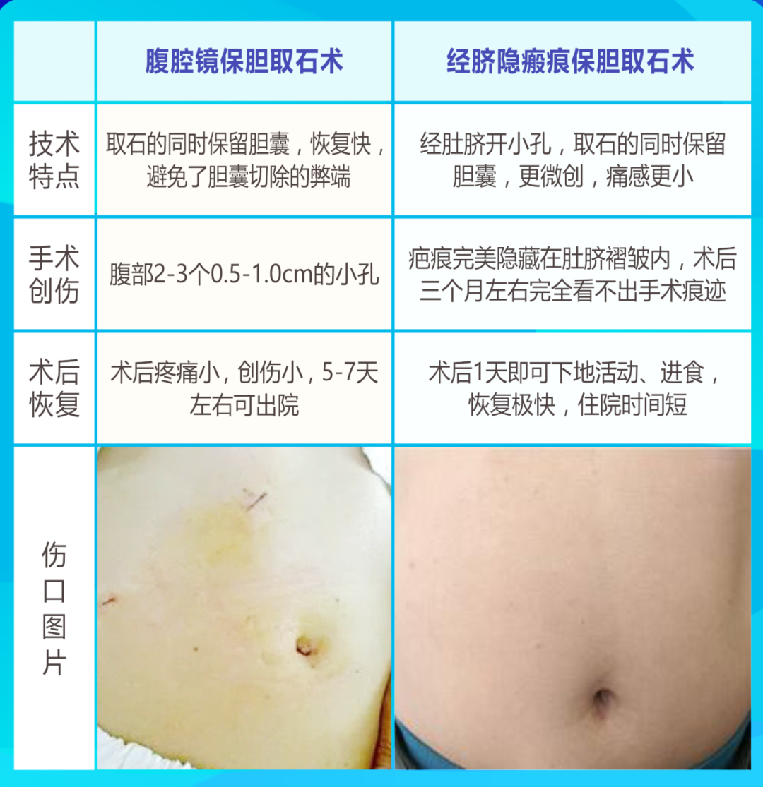 胆囊切除有危害吗？来听听肝胆专家怎么说【成都胆结石专科医院】(图4)