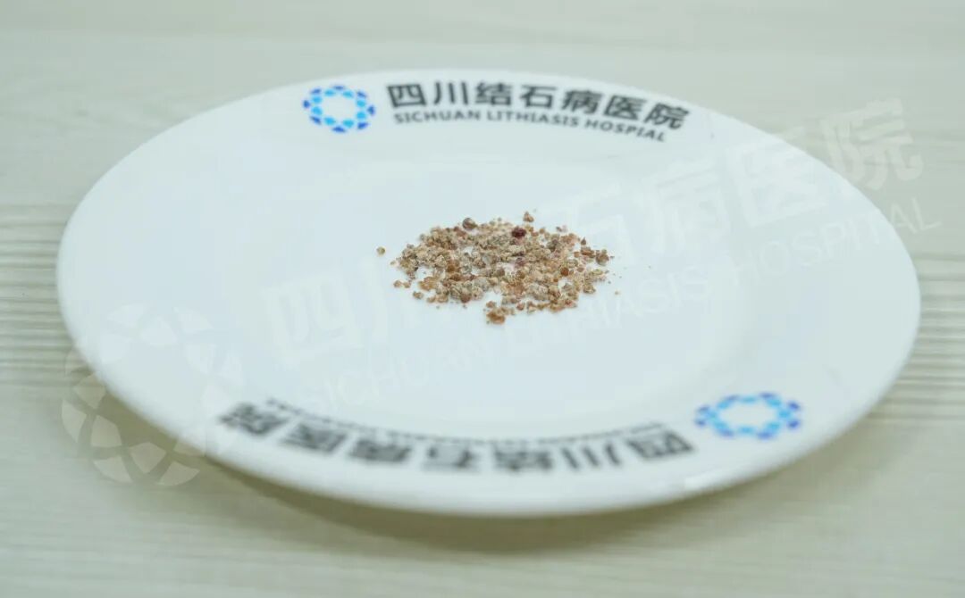 “到你们这当回家一样！”患者点赞四川结石病医院泌尿外科团队(图2)